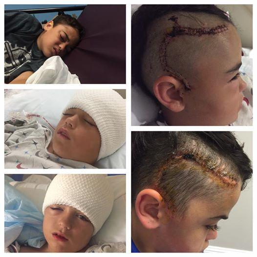 Mum Warns Parents About The Importance Of Helmets After Fall Almost Killed Son
